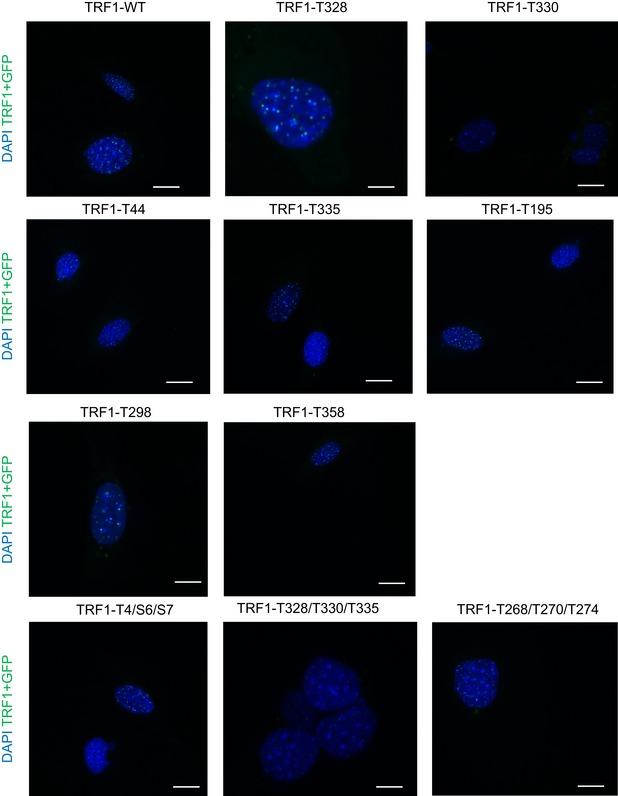 https://cdn.ncbi.nlm.nih.gov/pmc/blobs/2055/6609915/6a810d2a0142/EMMM-11-e10292-g005.jpg