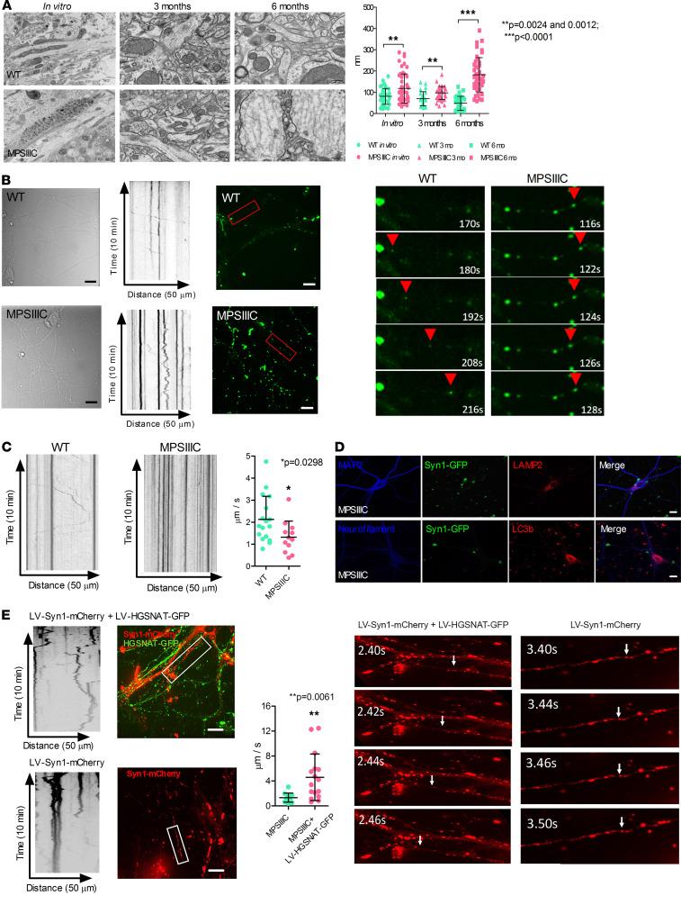 https://cdn.ncbi.nlm.nih.gov/pmc/blobs/2061/8410035/41a06fb65d96/jciinsight-6-142073-g128.jpg