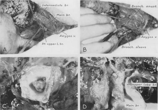 https://cdn.ncbi.nlm.nih.gov/pmc/blobs/2071/1613696/74e843861dd9/annsurg01302-0117-a.jpg