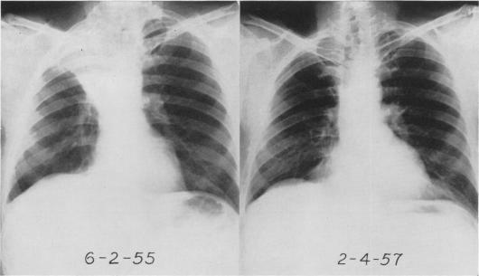 https://cdn.ncbi.nlm.nih.gov/pmc/blobs/2071/1613696/cd6cedfeebe1/annsurg01302-0116-a.jpg