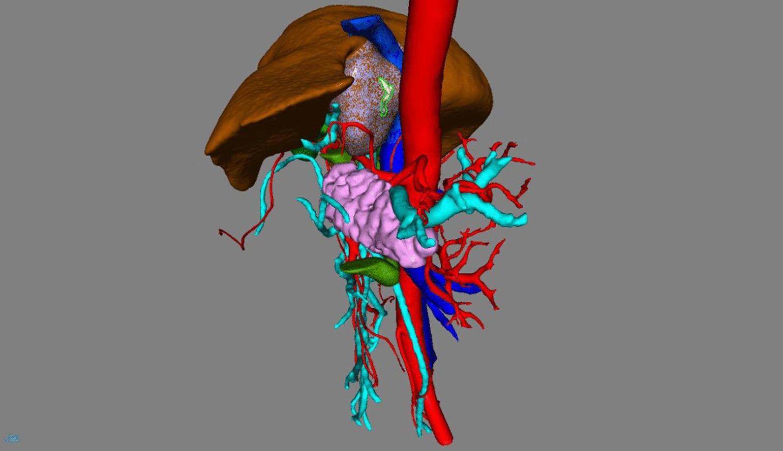 https://cdn.ncbi.nlm.nih.gov/pmc/blobs/2072/8742455/4e10fd7c975f/12893_2021_1457_Fig4_HTML.jpg
