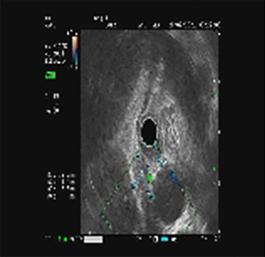 https://cdn.ncbi.nlm.nih.gov/pmc/blobs/2072/8742455/ad9381ddb698/12893_2021_1457_Fig2_HTML.jpg