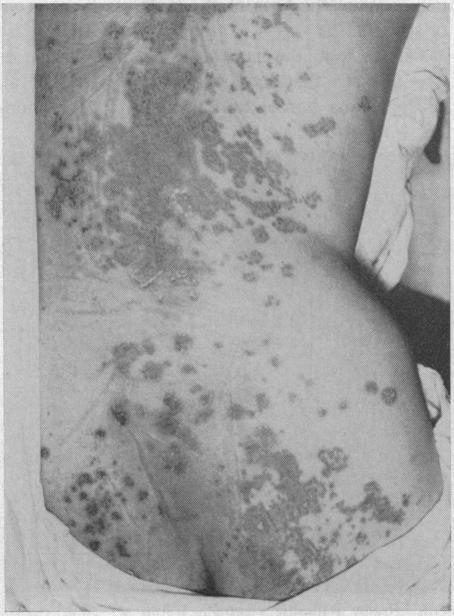https://cdn.ncbi.nlm.nih.gov/pmc/blobs/207c/1516324/25ce97506b95/califmed00050-0052-a.jpg