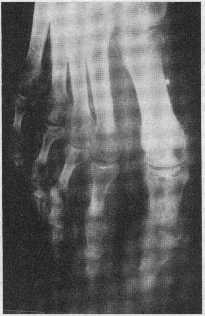 https://cdn.ncbi.nlm.nih.gov/pmc/blobs/207c/1516324/c8874f2b617b/califmed00050-0055-a.jpg