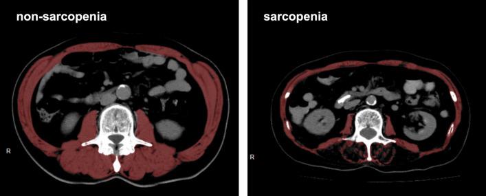 https://cdn.ncbi.nlm.nih.gov/pmc/blobs/207d/10409680/c119d5e69ba9/10434_2023_13569_Fig1_HTML.jpg