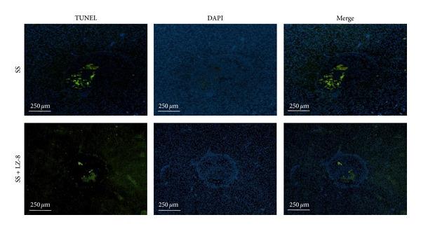 https://cdn.ncbi.nlm.nih.gov/pmc/blobs/207d/4026841/897c03bdefee/ECAM2014-916531.008.jpg