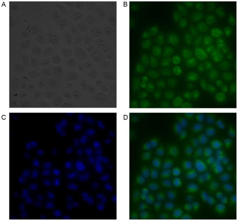 https://cdn.ncbi.nlm.nih.gov/pmc/blobs/207d/5482067/f3d2d7078c16/MMR-16-01-0625-g00.jpg