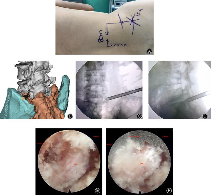 https://cdn.ncbi.nlm.nih.gov/pmc/blobs/207d/7957400/250fbb97e4ad/OS-13-659-g002.jpg