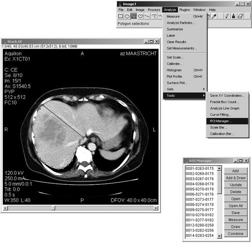 https://cdn.ncbi.nlm.nih.gov/pmc/blobs/2083/2039862/a70b1b3db677/268_2007_9197_Fig2_HTML.jpg