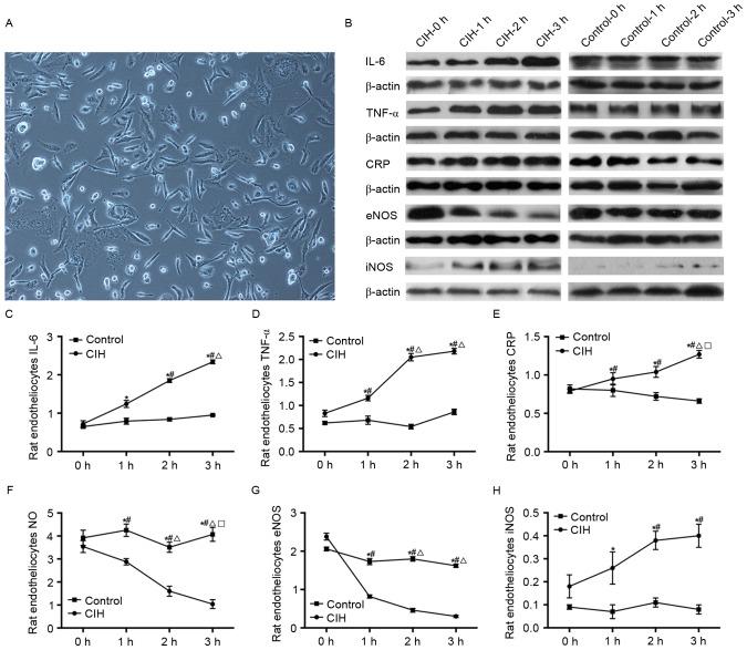 https://cdn.ncbi.nlm.nih.gov/pmc/blobs/208d/5779894/338f202aff8c/MMR-16-06-8092-g05.jpg