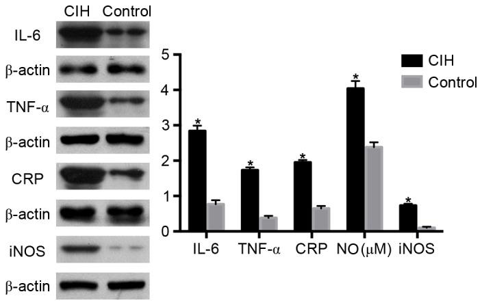 https://cdn.ncbi.nlm.nih.gov/pmc/blobs/208d/5779894/39a4461b3e35/MMR-16-06-8092-g04.jpg