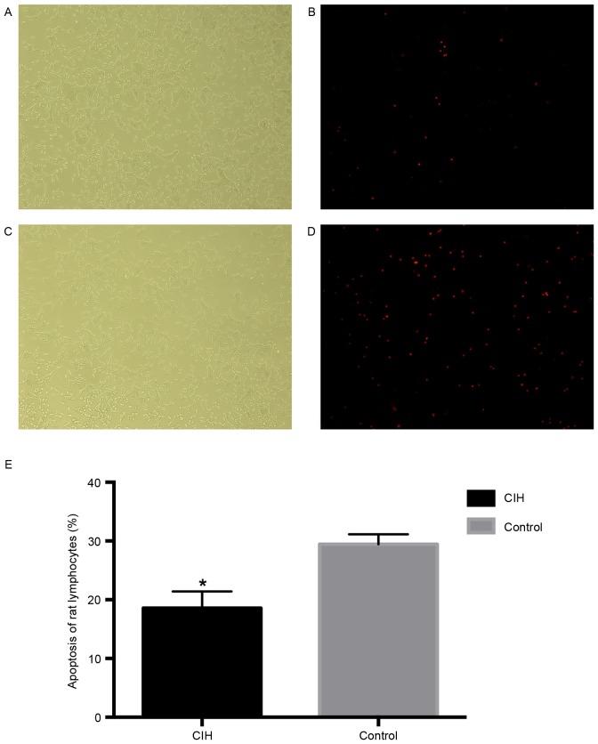 https://cdn.ncbi.nlm.nih.gov/pmc/blobs/208d/5779894/b07cdd6b7e6d/MMR-16-06-8092-g03.jpg