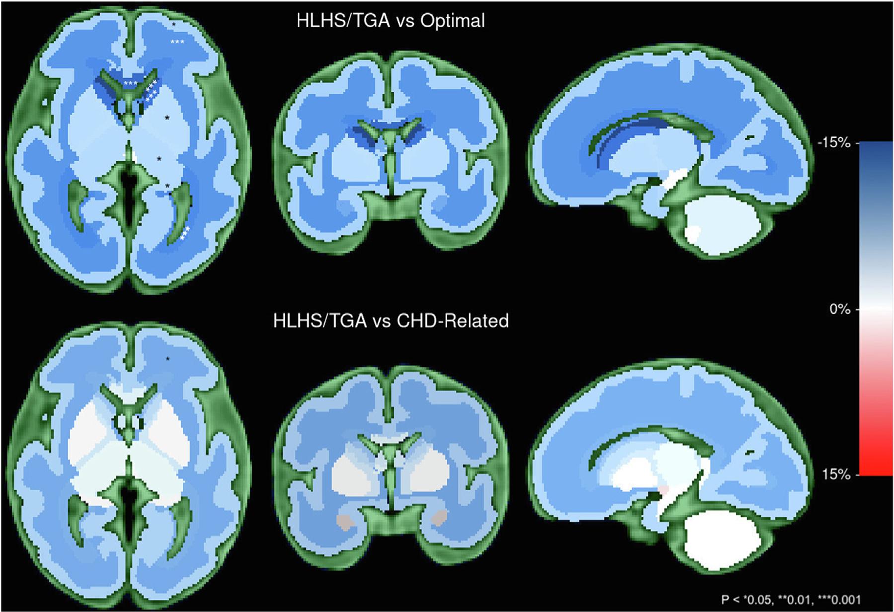 https://cdn.ncbi.nlm.nih.gov/pmc/blobs/208f/9905309/d14c1a752e73/nihms-1848789-f0001.jpg
