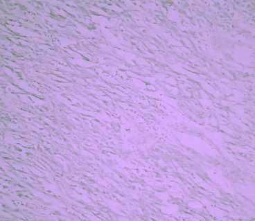 https://cdn.ncbi.nlm.nih.gov/pmc/blobs/2091/1876459/d27b1194d1e6/1477-7819-5-50-5.jpg
