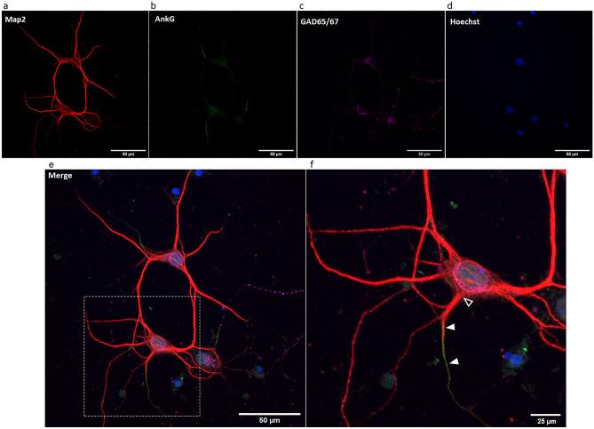 https://cdn.ncbi.nlm.nih.gov/pmc/blobs/2098/10794225/26e4fb54392b/41598_2024_51845_Fig1_HTML.jpg