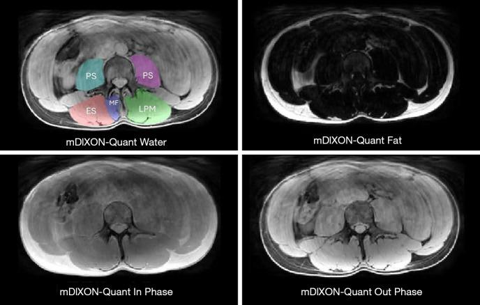 https://cdn.ncbi.nlm.nih.gov/pmc/blobs/209e/12290670/407500d28b0f/qims-15-07-6517-f1.jpg