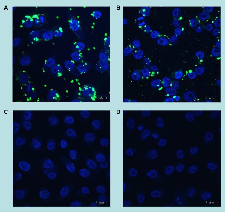 https://cdn.ncbi.nlm.nih.gov/pmc/blobs/20a0/8968073/89c501c8e1ff/IJN-17-1409-g0007.jpg