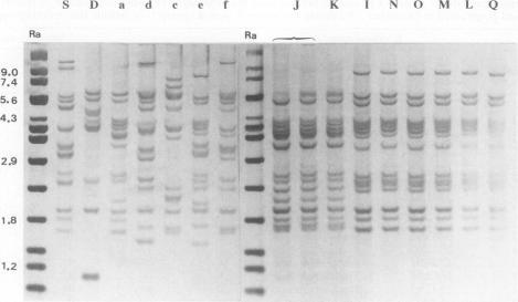 https://cdn.ncbi.nlm.nih.gov/pmc/blobs/20a1/263092/c21163559301/jcm00003-0030-a.jpg