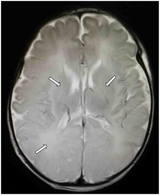 https://cdn.ncbi.nlm.nih.gov/pmc/blobs/20a8/6688136/0fd0705d5c20/10.1177_1179556519867953-fig2.jpg