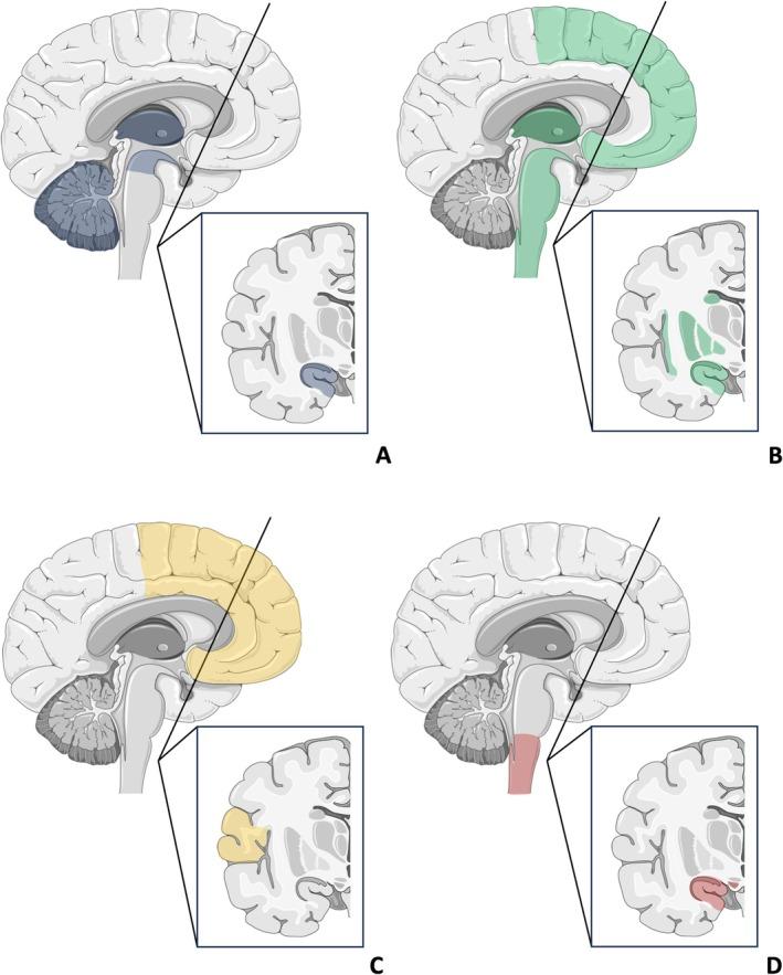 https://cdn.ncbi.nlm.nih.gov/pmc/blobs/20b7/11992477/6f7a21e34c64/ENE-32-e70101-g001.jpg