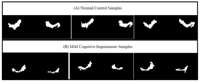 https://cdn.ncbi.nlm.nih.gov/pmc/blobs/20b8/10302234/b88d363f3710/sensors-23-05648-g005.jpg