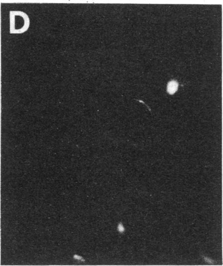https://cdn.ncbi.nlm.nih.gov/pmc/blobs/20b8/279540/3158c08a161f/pnas00254-0034-d.jpg