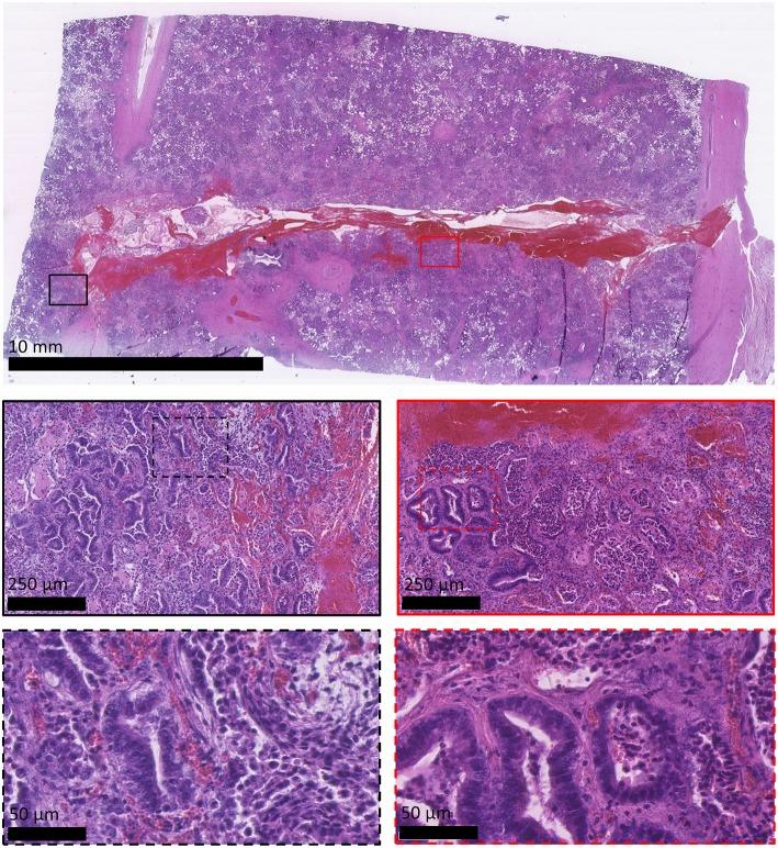 https://cdn.ncbi.nlm.nih.gov/pmc/blobs/20b8/6611418/6529752970d2/fonc-09-00534-g0010.jpg