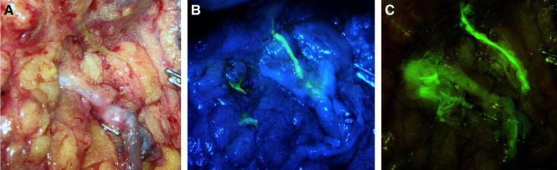 https://cdn.ncbi.nlm.nih.gov/pmc/blobs/20bd/7929616/b6cbe43d12f6/gox-9-e3431-g003.jpg