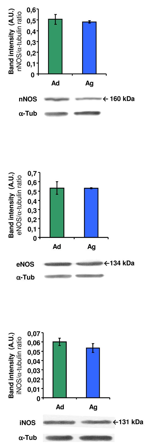 https://cdn.ncbi.nlm.nih.gov/pmc/blobs/20bf/2905430/7519865db9c1/1471-2202-11-78-2.jpg