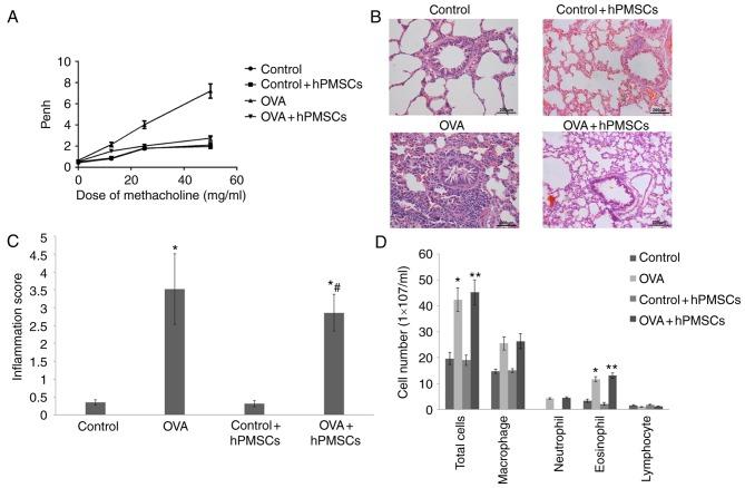 https://cdn.ncbi.nlm.nih.gov/pmc/blobs/20c0/5779899/e02483a12ac3/MMR-16-06-8137-g02.jpg