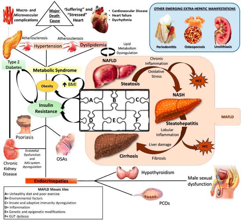 https://cdn.ncbi.nlm.nih.gov/pmc/blobs/20c9/8156164/1d877c4fffb9/nutrients-13-01679-g001.jpg