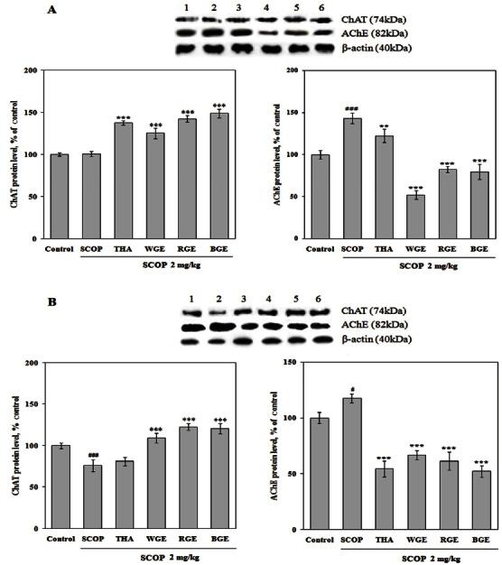 https://cdn.ncbi.nlm.nih.gov/pmc/blobs/20ce/3659552/bf8f8993500d/grosbr-35-421-g004.jpg