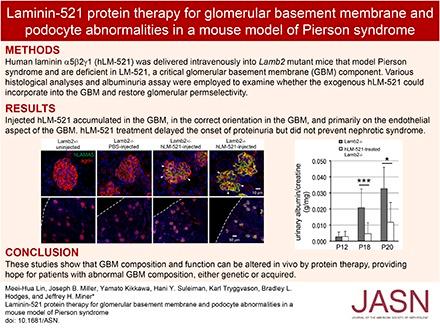 https://cdn.ncbi.nlm.nih.gov/pmc/blobs/20cf/5967757/ab7409d1ddc7/ASN.2017060690absf1.jpg