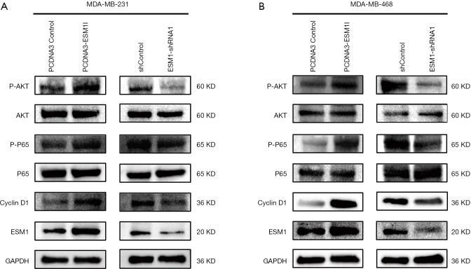 https://cdn.ncbi.nlm.nih.gov/pmc/blobs/20d0/8105853/439720b508a6/atm-09-07-533-f5.jpg