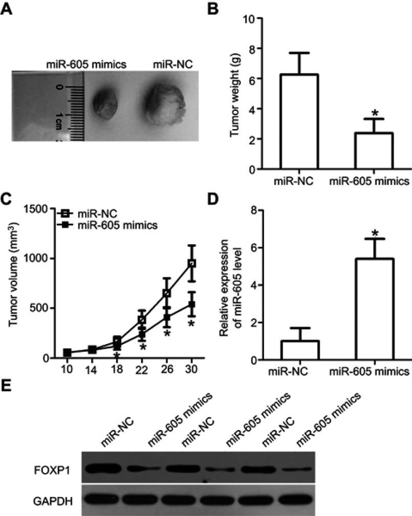 https://cdn.ncbi.nlm.nih.gov/pmc/blobs/20d2/6529030/1c61dcc02f3c/OTT-12-3765-g0006.jpg