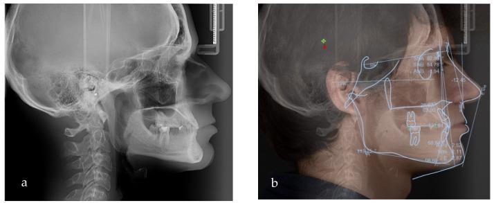 https://cdn.ncbi.nlm.nih.gov/pmc/blobs/20d4/11051546/573c5868e18b/jpm-14-00350-g005.jpg