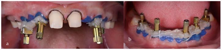 https://cdn.ncbi.nlm.nih.gov/pmc/blobs/20d4/11051546/cc1ba696cef1/jpm-14-00350-g017.jpg
