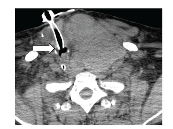 https://cdn.ncbi.nlm.nih.gov/pmc/blobs/20d4/3444054/10e63375e71a/CRIM2012-627415.002.jpg