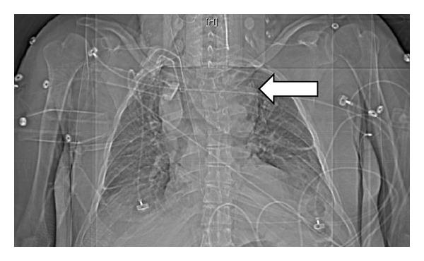 https://cdn.ncbi.nlm.nih.gov/pmc/blobs/20d4/3444054/e3f9dfeca5a0/CRIM2012-627415.001.jpg