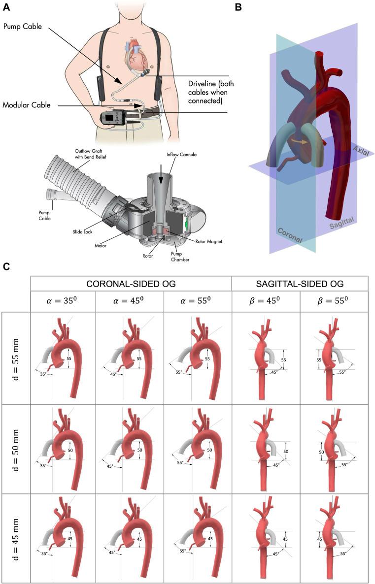 https://cdn.ncbi.nlm.nih.gov/pmc/blobs/20d5/11084291/ca236038e364/fbioe-12-1279268-g001.jpg