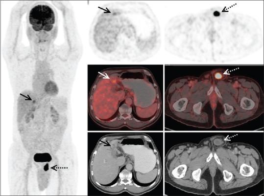 https://cdn.ncbi.nlm.nih.gov/pmc/blobs/20d8/6593951/c293958cad29/IJNM-34-247-g001.jpg