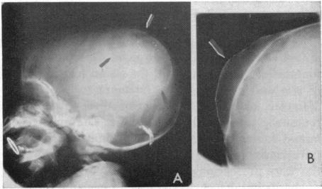 https://cdn.ncbi.nlm.nih.gov/pmc/blobs/20db/1515600/0ecf03b6f214/califmed00075-0011-b.jpg