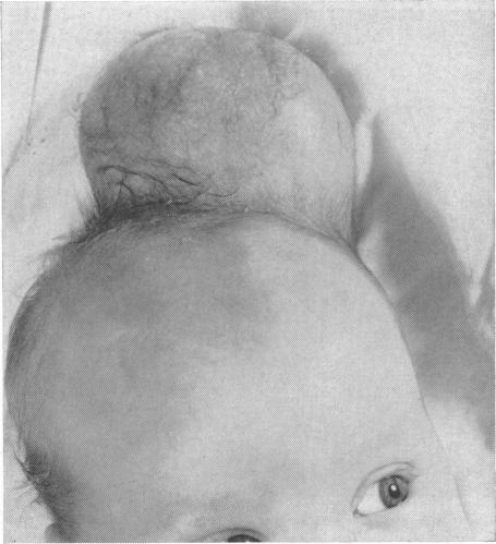 https://cdn.ncbi.nlm.nih.gov/pmc/blobs/20db/1515600/ac222d7abc82/califmed00075-0013-a.jpg