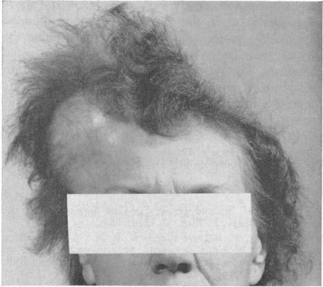 https://cdn.ncbi.nlm.nih.gov/pmc/blobs/20db/1515600/bb6c440306fe/califmed00075-0014-a.jpg