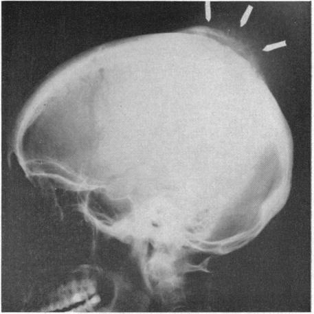 https://cdn.ncbi.nlm.nih.gov/pmc/blobs/20db/1515600/dd95a95e2621/califmed00075-0014-b.jpg