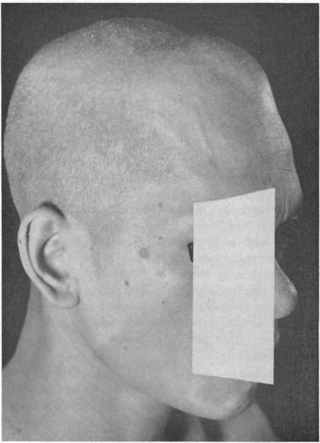https://cdn.ncbi.nlm.nih.gov/pmc/blobs/20db/1515600/e27b5ea7301e/califmed00075-0013-b.jpg