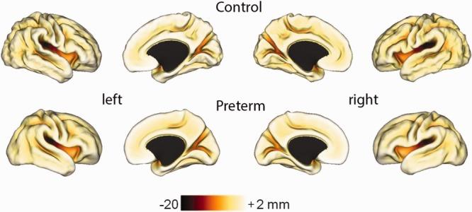 https://cdn.ncbi.nlm.nih.gov/pmc/blobs/20db/4383353/8c15d5e22652/ana0077-0154-f1.jpg
