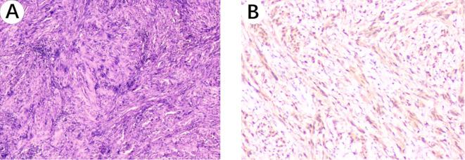 https://cdn.ncbi.nlm.nih.gov/pmc/blobs/20de/12040618/24739cd1aff8/fonc-15-1573436-g004.jpg
