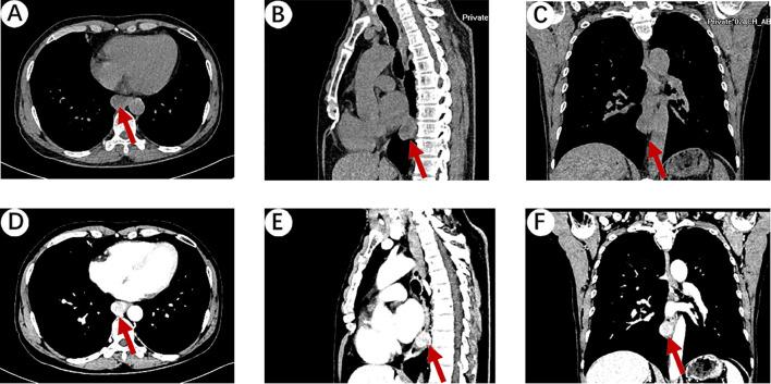 https://cdn.ncbi.nlm.nih.gov/pmc/blobs/20de/12040618/d7c2a249727a/fonc-15-1573436-g001.jpg