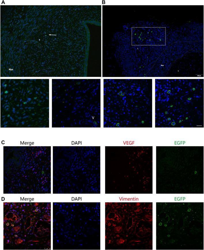 https://cdn.ncbi.nlm.nih.gov/pmc/blobs/20de/9081369/05a4970e1df1/fbioe-10-735465-g004.jpg